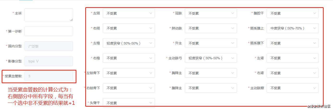 动态表单设计-指导思想